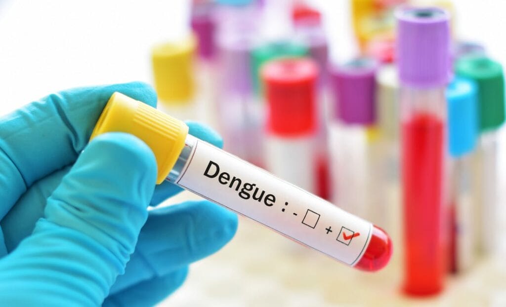 Dengue virus positive