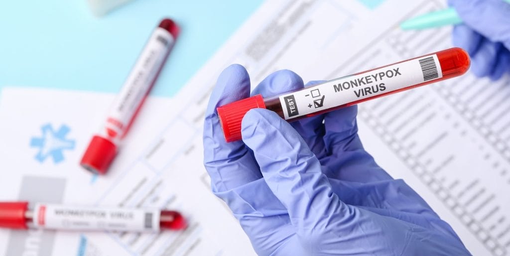 Vaiolo delle scimmie adobe